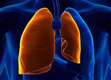Pneumothorax treatment in delhi and gurgaon Pneumothorax treatment in delhi and gurgaon