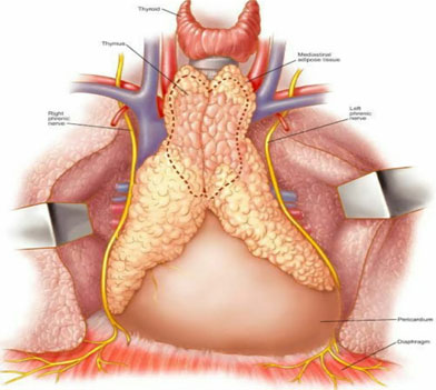 Thymus Gland and extent of Thymectomy